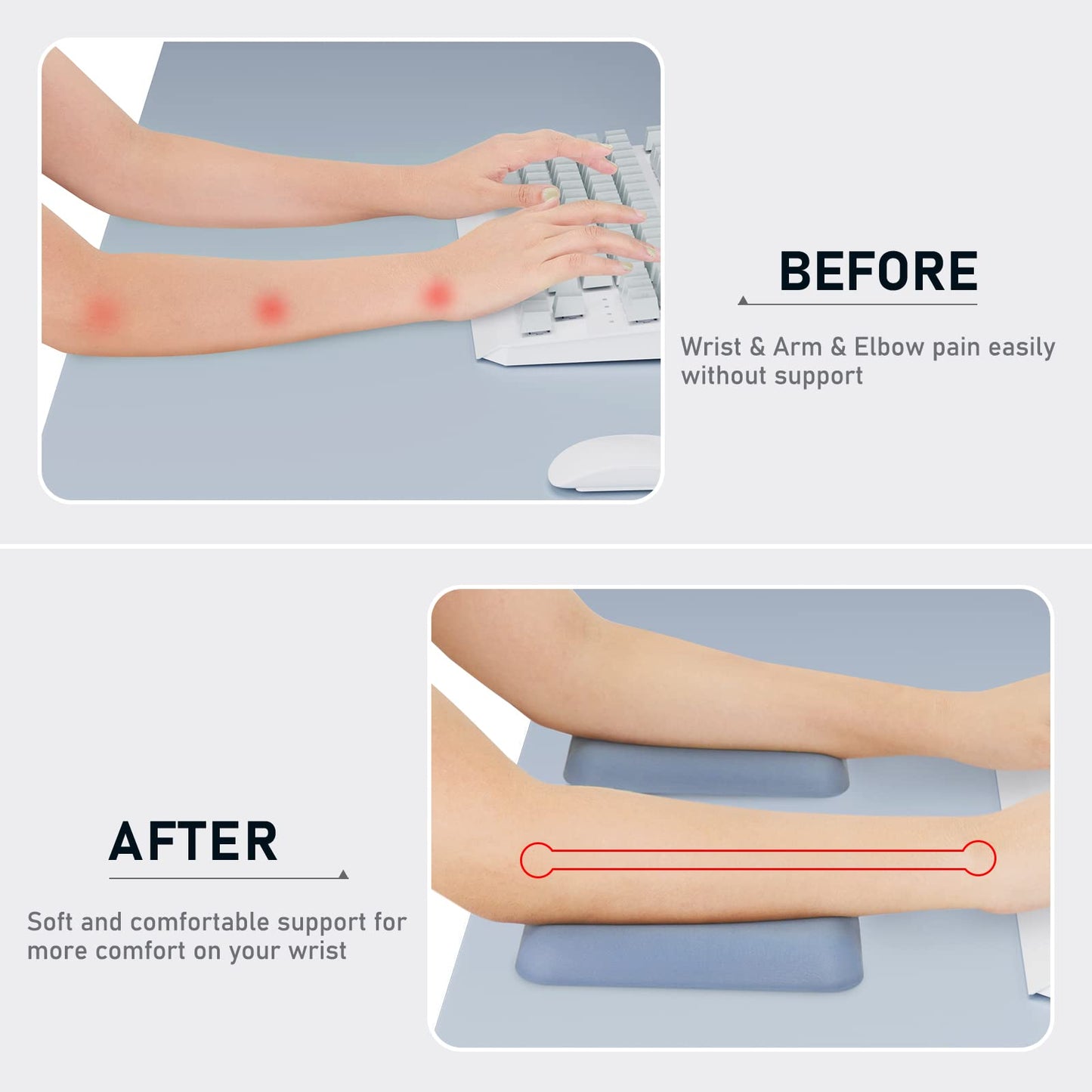 Leolee Elbow Rest Pads for Desk, Gel Ergonomic Wrist Rest Arm Rest Pads