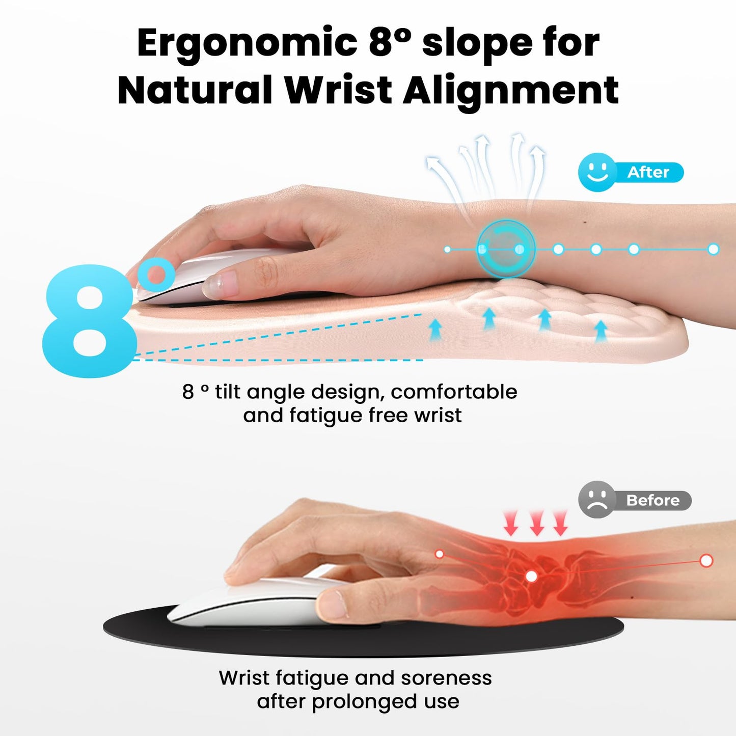 EooCoo Massage Ergonomic Mouse Pad with Dual-Slope Design Wrist Rest